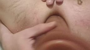 Enema, Anal Shower. Close-up View Through Anal Mirror. Anal with Water. Filling Anal with Water