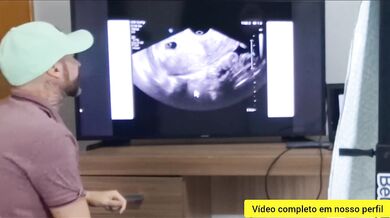 Wife creampied by her gynecologist during real ultrasound exam