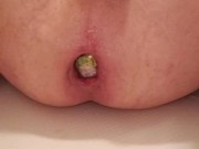 Anal stretch and fuck