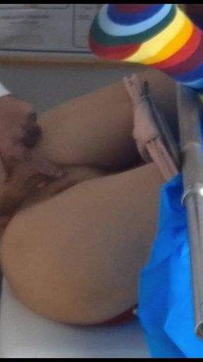 The Gynecologist Couldn't Oppose the Patient's Vagina!