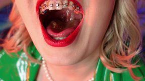 food fetish - eating blowing candy - ASMR video of chewing girl in BRACES with all sounds close up