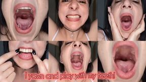 While I yawn, I'll show you my mouth in detail