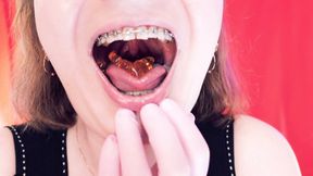 Asmr Eating Jelly Bears With Braces by Arya Grander