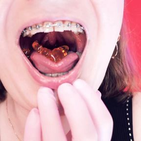 Asmr Eating Jelly Bears With Braces by Arya Grander