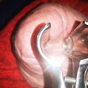 Speculum Inside My Cock Hole Made Me Cum