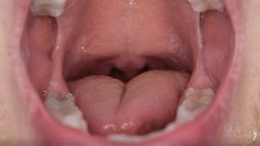 Close Up Mouth Teeth Tongue Uvula Spit