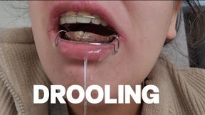 DROOLING FETISH (USING RETAINERS)