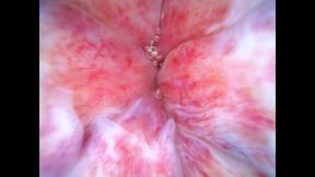 Adventure in my ass cave