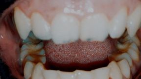 Dirty teeth
