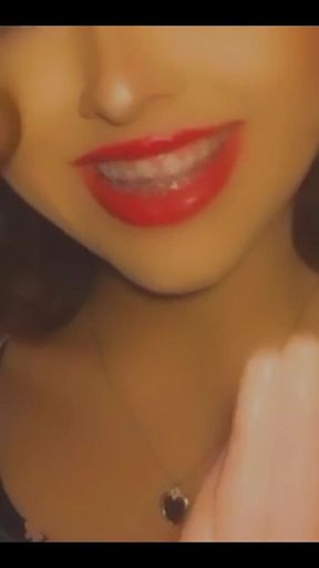 Braceface Baby