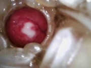 Internal view of me cumming inside previously creampied Fleshlight Quickshots