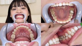 Urara - Watching Inside mouth of Japanese cute girl bite-264-1 - 1080p