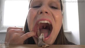 Zahnshmerzen (Toothache)