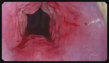 Japanese Mom Uterus Filling: Big Objects Insertion & Cervix Dilation Top rated