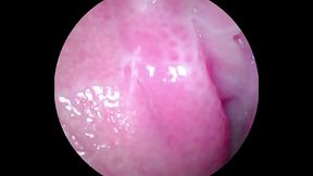 Camera deep inside of the wet pussy and captured the intense female orgasm!!