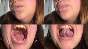 Saliva bubbles, very wet mouth