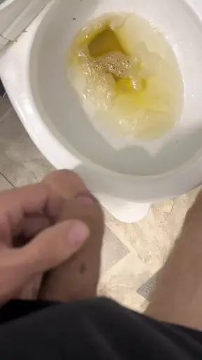 Guy With Cerebral Palsy has Massive Load of Pee for You