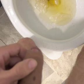 Guy With Cerebral Palsy has Massive Load of Pee for You