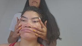 Facial Deformity: A Flattened Face with Strange Facial Parts