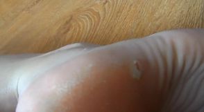 Foot play with hair dryer