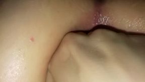 Anal gaping close up