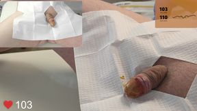 20 French Foley Catheter Insertion