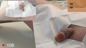 20 French Foley Catheter Insertion