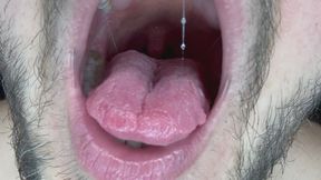 Uvula and Torn Tongue are extremely close