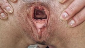 Naked Outdoors with Wide Open Pussy Showing My Cervix and Pissing