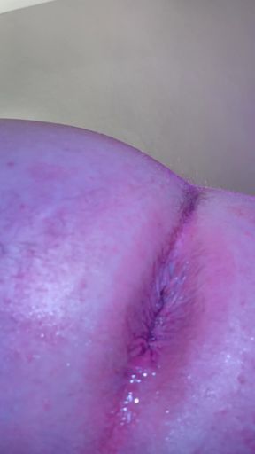 Anal Finger Prolapse