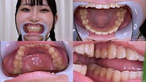 Mea Amemi - Watching Inside mouth of Japanese cute girl