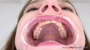 Inside My Mouth - Lola - Mouth retractor clip! (FULLHD quality)