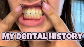 My dental history