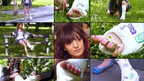 Hugi Term SLWC Gimping in the Park Looking for Treatment of Smelly Cast Foot