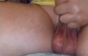 Cbt insertion extrem sunding- elastrator band