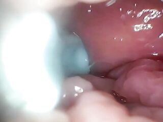 Jizz in Cervix Wide Stretching Snatch Endoscope!