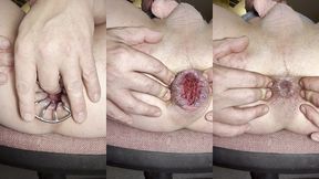 reneenicolecd - update #51 - anal cage gape hole pov - jun 18, 2026