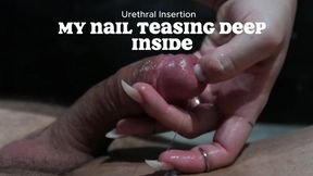 Urethral Insertion - My Nail Teasing Deep Inside