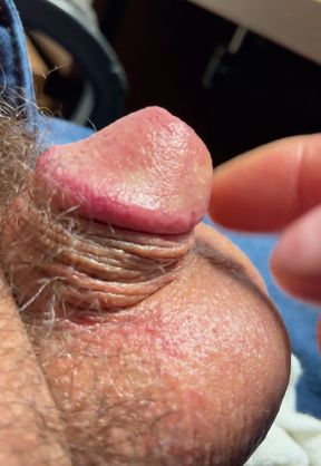 Do they sell miracle grow for wieners?