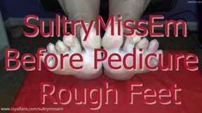 Before pedicure rough feet