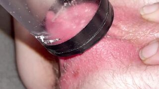 Clitoris blown by vacuum cleaner inside clear tube