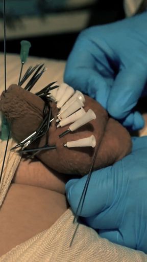 Medical Play Fun, Mummification, Needle CBT and Electro