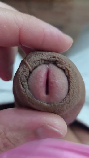 The Head of My Penis