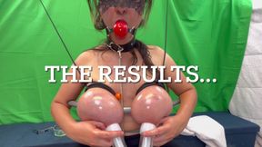 Tit Busting My Bruised Tits