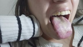 My tongue is white, cracked, and defective.