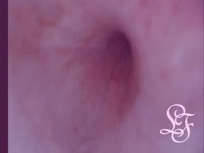 Best Pee Hole Video Ever!