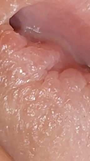 Enlargement of the Deep Urethral Hole!!