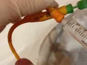 removal of a urological catheter
