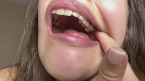 Dental Mirror Deep in My Mouth – Extreme Close-Up Teeth Inspection POV