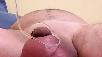 Hairy German Bear Infuses Two Liters of Saline into Cock